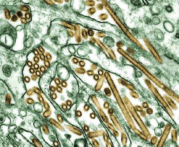 A closer look at the avian influenza virus. This image shows the virus at a microscopic level of detail.