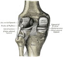 Knee ligament injury video