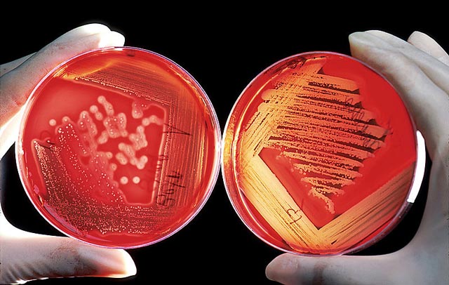 This photo shows two agar plates of red blood cells with the sample on the left showing an infection.