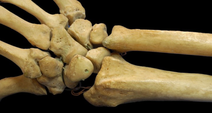 This photo shows a close up view of the radius and ulna bones that
 make up part of the human arm and the overall human skeleton.