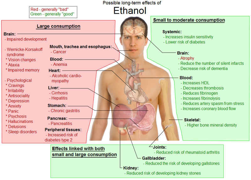 This diagram shows many of the possible long term side effects of ethanol (alcohol) on the human body. It compares those that can occur from moderate consumption against those that might occur from large consumption. Some of the positive and negative effects include impaired development, decreased risk of dementia, chronic gastritis, sleep disorders and a lower risk of diabetes.