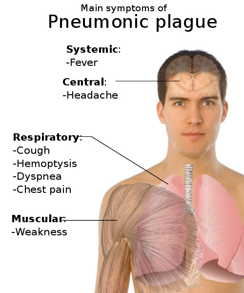 This diagram shows the main symptoms of the pneumonic plague. They include conditions such as fever, headache, chest pain, coughing and muscular weakness.