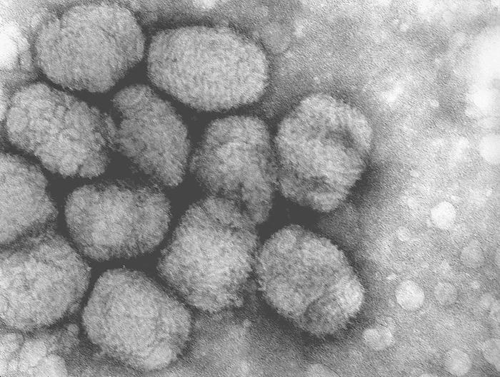 This image shows a transmission electron micrograph of the smallpox virus. Smallpox is a disease that has been successfully eradicated by humans.