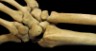 radius and ulna